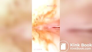 Gassy Chinese lady pooping in her pants