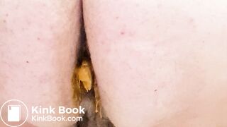 Mixed Poop