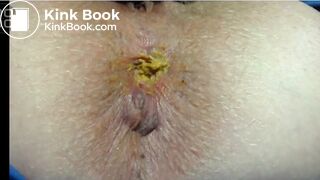 Close Up Pooping Compilation