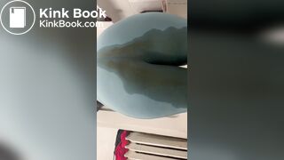 Unsuspecting Laxative Accident