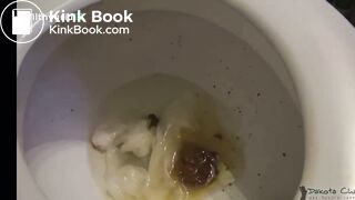 D&k@ta pooping
