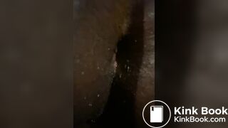 After anal