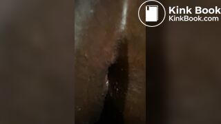 After anal
