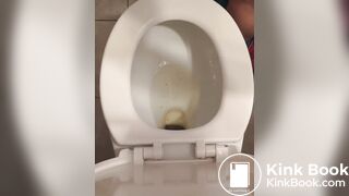 giant turd birth from hairy shithole