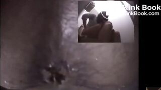 Constipated bowlcam