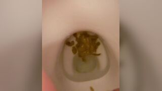 girl diarrhea in toilet - video 2