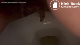 Massive poop - video 10
