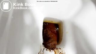 That must have hurt (unflasheable)