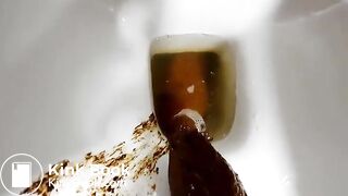 That must have hurt (unflasheable)