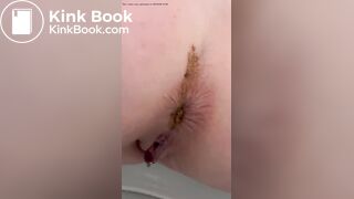Shit on toilet - video 5