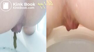 Amazing Distended Assholes ! - video 4
