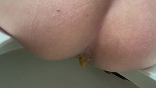 another nice toilet diarrhea