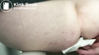 Dirty hairy fatty poops in a hostel public toilet