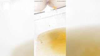 腹泻拉肚子