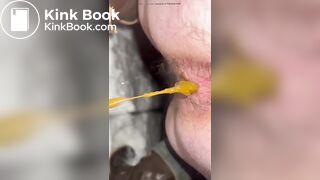 Dirty hairy ass slut shitting and pissing on the snow