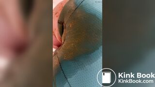 Diarrhea Accident comp