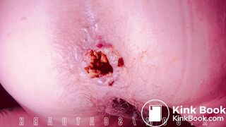 Lovely pooping @scatdark