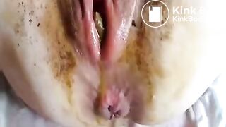 Vagina poo..