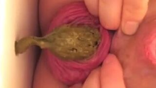 Prolapse scat - video 10
