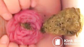 Prolapse scat - video 10