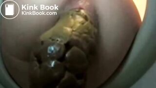 Close up of a woman pooping - video 17