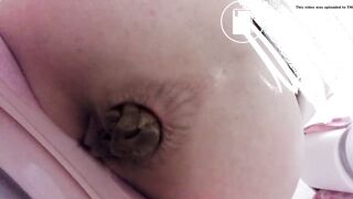 Constipated situation