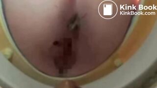 Close up of a woman pooping - video 19