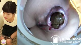 Japanese gal with big asshole drops a decent shit 2