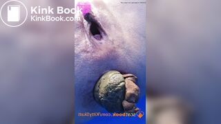 Dixie POV massive shits