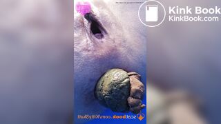 Dixie POV massive shits