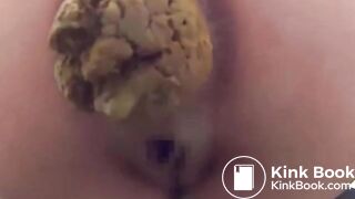Close up of a woman pooping - video 16