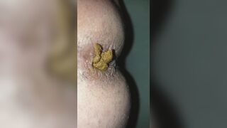 I poop on december 27th