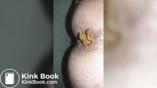 I poop on december 27th