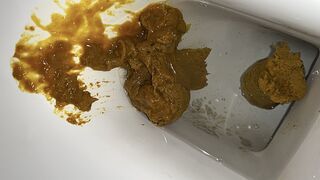 Soft shit to diarrhea pt1