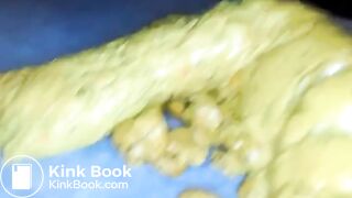 Yellow poo with seeds..