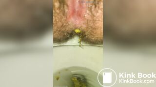 Shitting Like An Uncorked Champagne Bottle