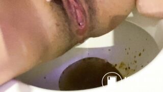 Shitting diarrhea squatting on toilet