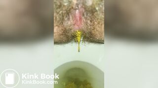 Dripping Shit From My Hairy Trans Ass
