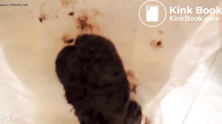 Poo diaper..