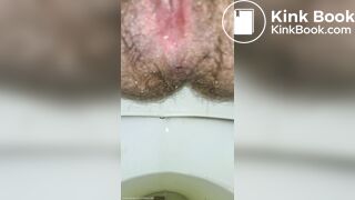 Little Balls Of Shit + Pissing Like A Broken Sprinkler