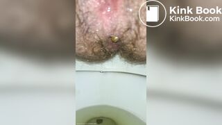 Little Balls Of Shit + Pissing Like A Broken Sprinkler