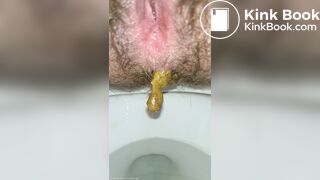 Little Balls Of Shit + Pissing Like A Broken Sprinkler