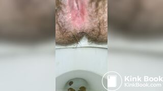 Little Balls Of Shit + Pissing Like A Broken Sprinkler