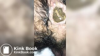 Thick and appetizing poop coming out of my hairy ass