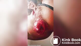 Prolapso Gigante audio de mexicana tragamierda