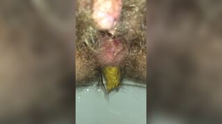 Emptying My Hairy Shitter