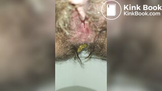 Emptying My Hairy Shitter