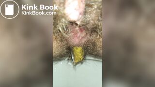 Emptying My Hairy Shitter