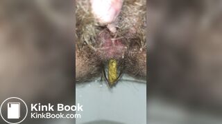 Emptying My Hairy Shitter