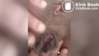 Black ebony brown eye got pink eye (end)